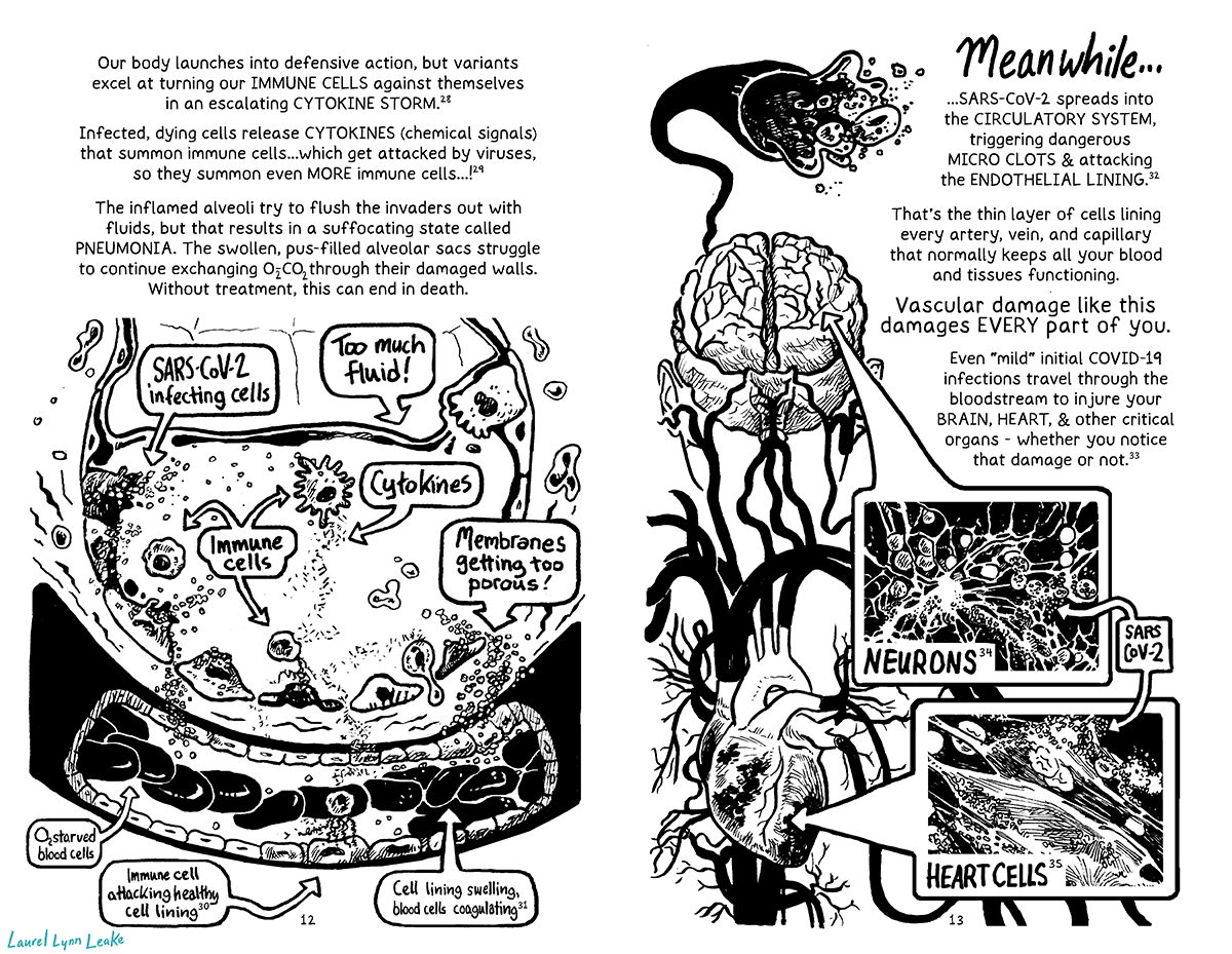 L: This large body of text starts off the page: “Our body launches into defensive action, but variants excel at turning our IMMUNE CELLS against themselves in an escalating CYTOKINE STORM. e28 Infected, dying cells release CYTOKINES (chemical signals) that summon immune cells...which get attacked by viruses, so they summon even MORE immune cells...! e29 The inflamed alveoli try to flush the invaders out with fluids, but that results in a suffocating state called PNEUMONIA. The swollen, pus-filled alveolar sacs struggle to continue exchanging O-CO through their damaged walls. Without treatment, this can end in death.” Below, a diagram shows all of this happening. We see the inside of an alveolar sac that is being filled with “too much fluid!” as one bubble declares. And inside of the fluid, many little balls are coming up to one of the larger shapes at the wall of the sac, labeled “SARS-COV-2 infecting cells”. A few big blobby orbs are labeled “Immune cells”, and the little speckles that are flying away from one are labeled “Cytokines”. The one sending the cytokines looks unusual, suggesting infection, and another receiving the cytokines is attacking one of the cells on the cell wall. On the periphery of the wall where the semi-porous membrane was on the previous page, it’s much thicker, and text says “membrane’s getting too porous”. Little SARS-COV-2 circles are spilling through the wall and into a capillary. Where the virus is coming in, the walls of the capillary are thicker and an arrow points to it from a bubble, explaining “Cell lining swelling, blood cells coagulating e31 “. The big oblong blood cells flow by a lighter orb that’s extending little tentacle things at the wall of the capillary, causing it to swell. Text explains “Immune cell attacking healthy cell lining e30”. Another bubble points at the blood cells and says “02 starved blood cells”. R: Stylized handwriting at the top says “Meanwhile…” and text continues “...SARS-CoV-2 spreads into the CIRCULATORY SYSTEM, triggering dangerous MICRO CLOTS & attacking the ENDOTHELIAL LINING. e32 That’s the thin layer of cells lining every artery, vein, and capillary that normally keeps all your blood and tissues functioning.” To the left, we see blood splashing out of vein and little SARS-COV-2 particles within it. The vein connects to a diagram of a brain below, and that down through thicker and thicker blood vessels until it reaches the heart. The text gets a little larger for emphasis here, and says “Vascular damage like this damages EVERY part of you.” In regular text below it continues “Even “mild” initial COVID-19 infections travel through the bloodstream to injure your BRAIN, HEART, & other critical organs - whether you notice that damage or not. e33” And arrow pointing at the brain leads to a zoomed in shot of spindly neurons covered with tiny circles, while another arrow shows a zoomed in shot of heart cells shows fibrous stretched forms covered with more little tiny circles. Arrows point at the tiny circles in both, and labels them “SARS-COV-2”.